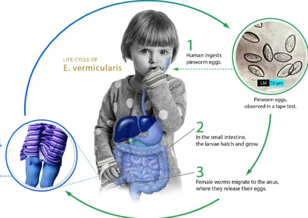 Life Cycle of Enterobiasis