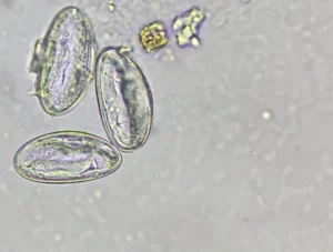 Life Cycle of Enterobiasis