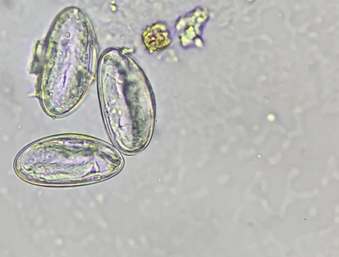 Life Cycle of Enterobiasis